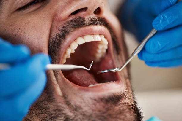 Best Emergency Treatment for Dental Infections or Abscesses in Lake Butler, FL
